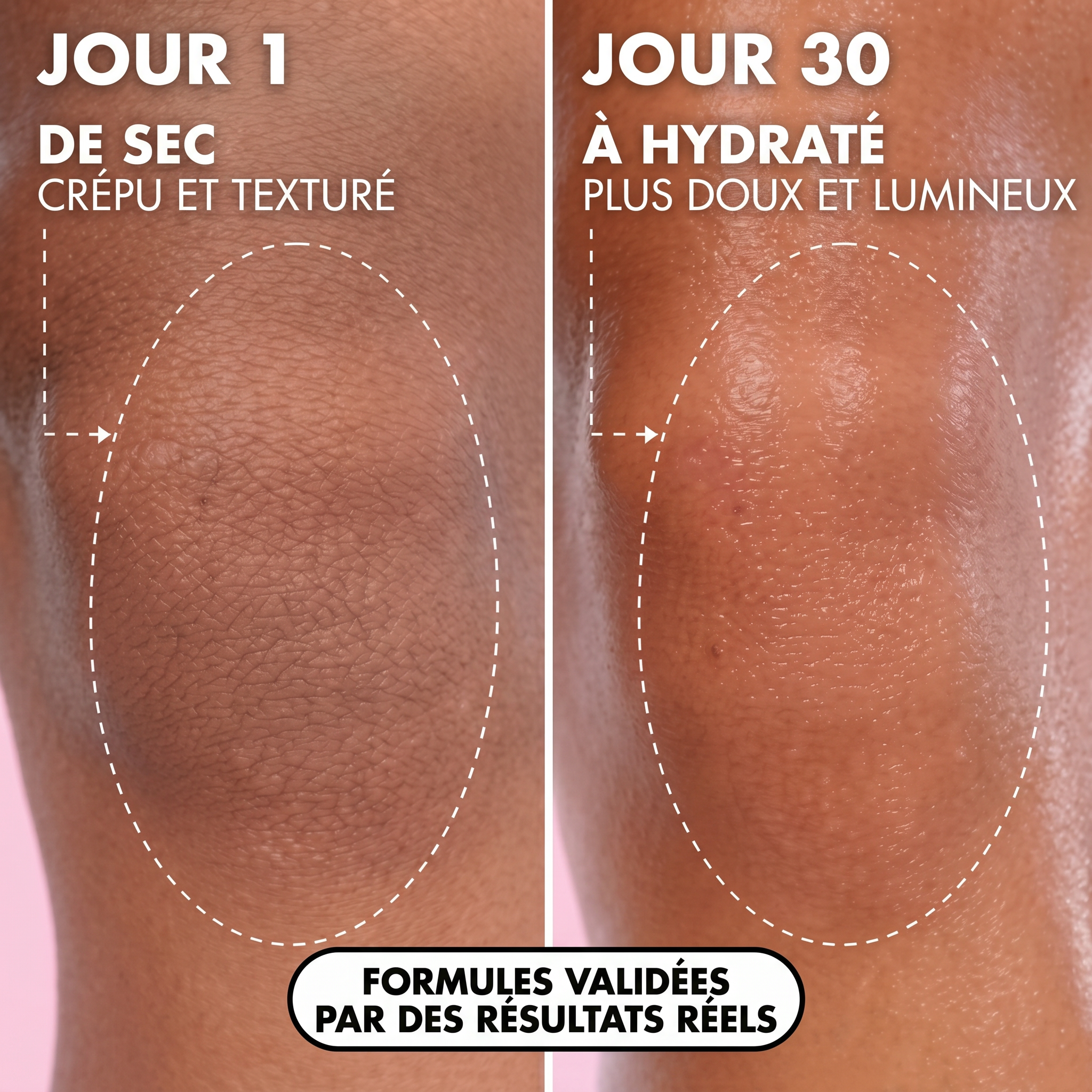 Goddess Glow™ - Huile régénérante après épilation